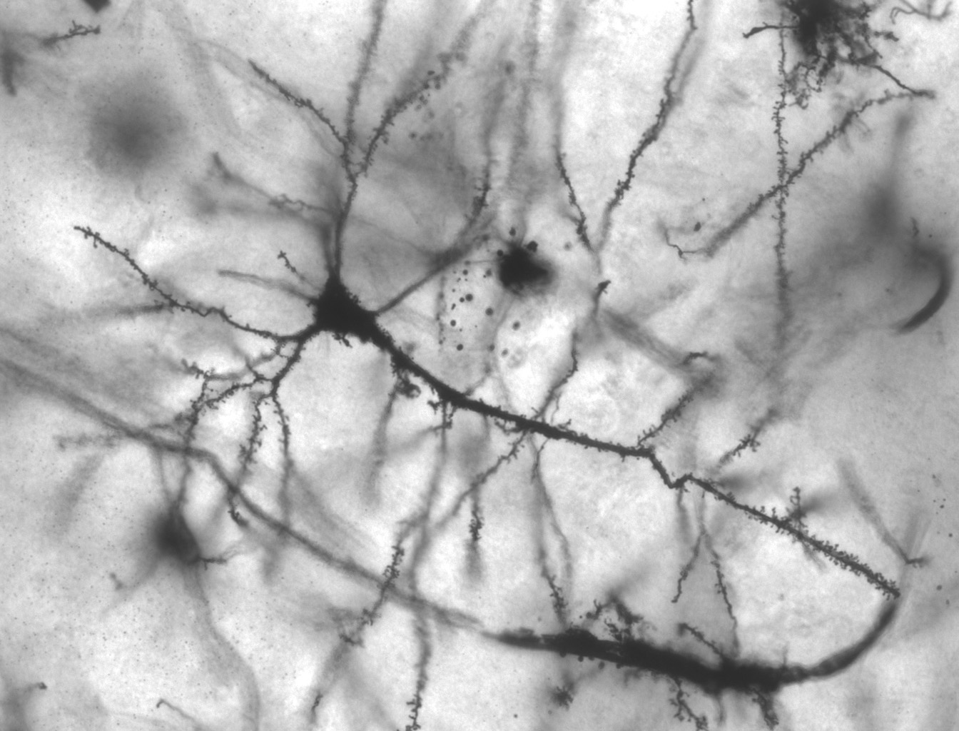 A photograph of a pyramidal neuron in the hippocampus